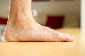 Flatfoot Issues