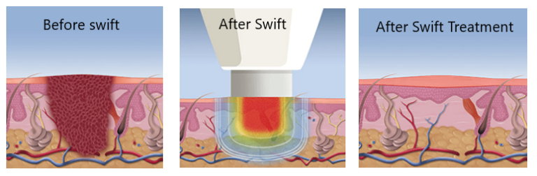 swiftc