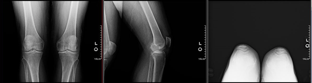 Xray1
