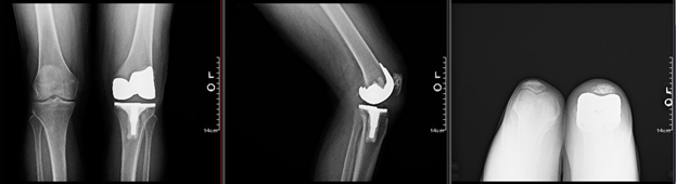 Xray2