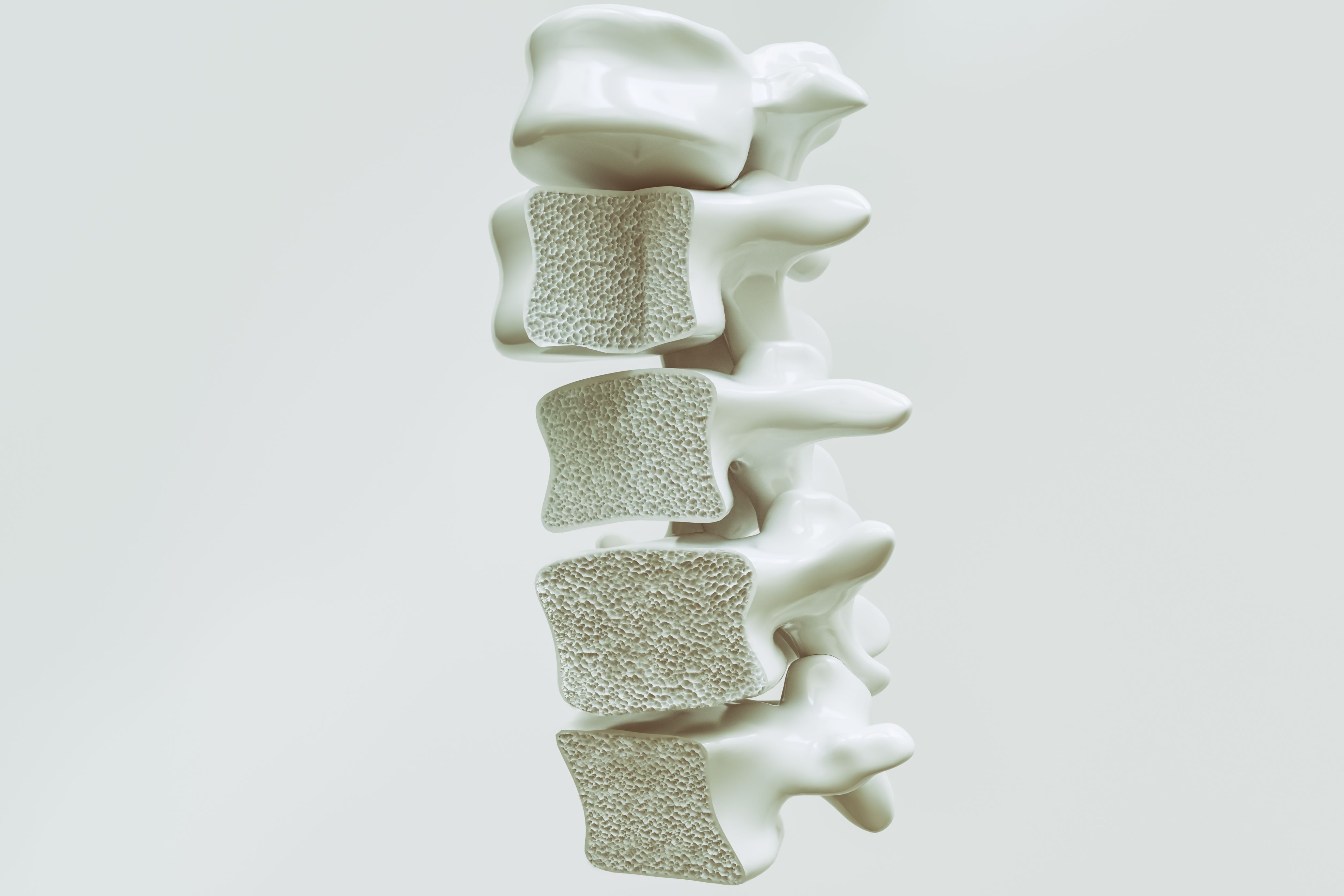 _Preventing Osteoporosis