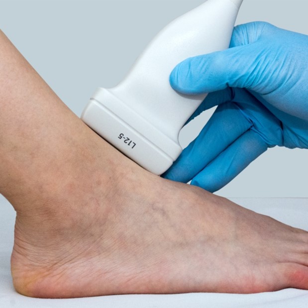Musculoskeletal Ultrasound