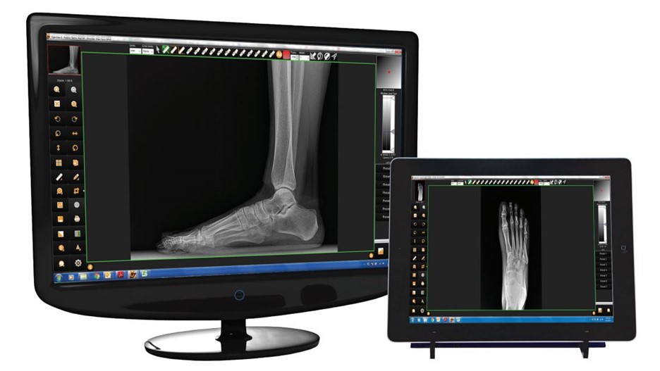 Digital Xrays