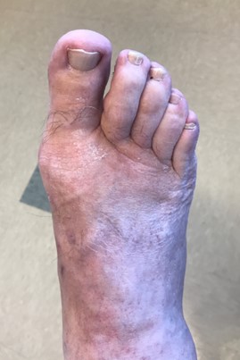 Post op example 1