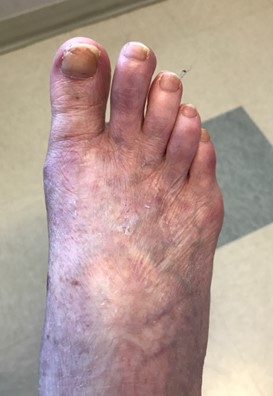 Post op example 2