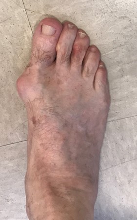 Pre op example 1