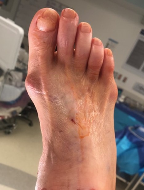 Pre op example 2 