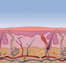 After Treatment