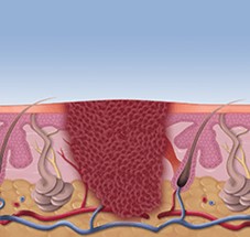 Before Treatment