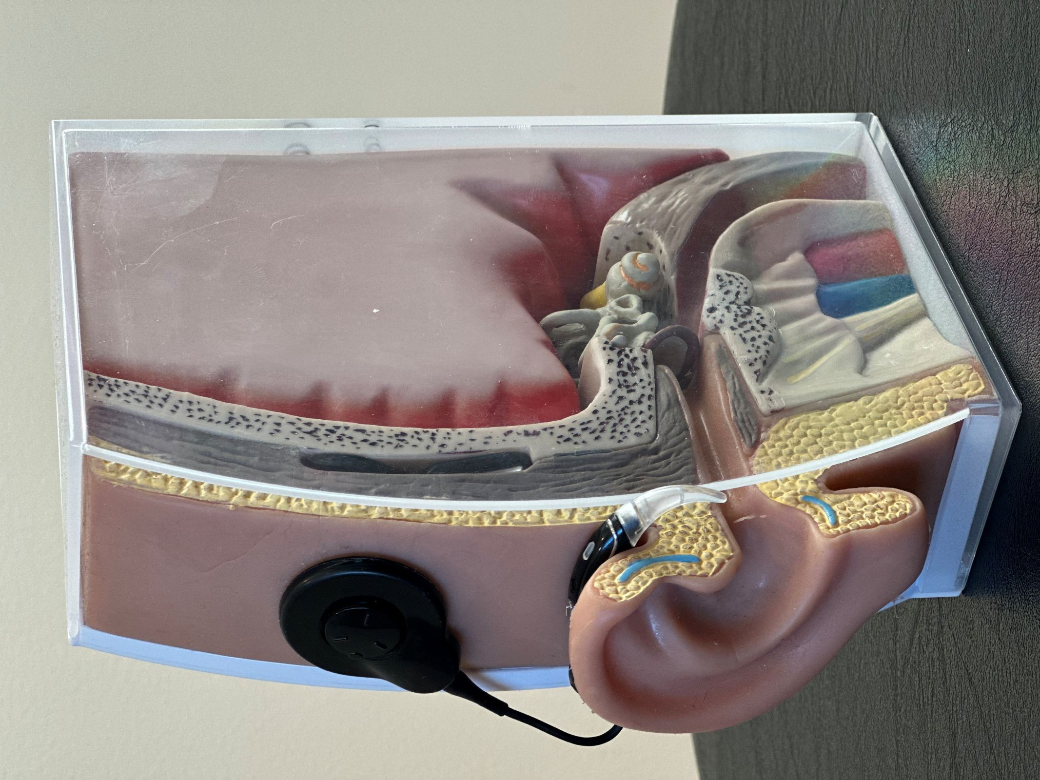 Cochlear implant on model