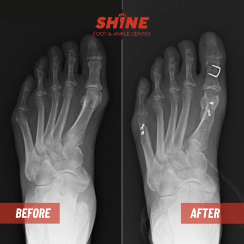 LT_scarf_and_akin_tailors_correction