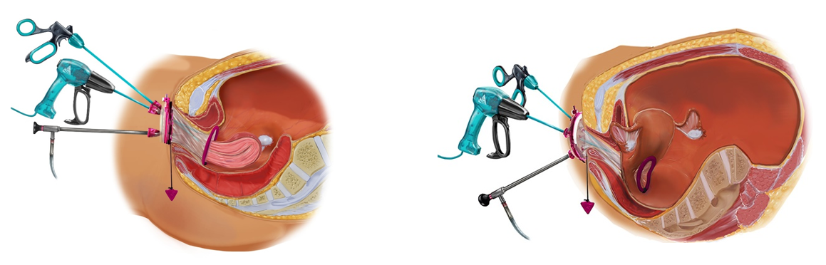 Informational graphic about the surgery tools