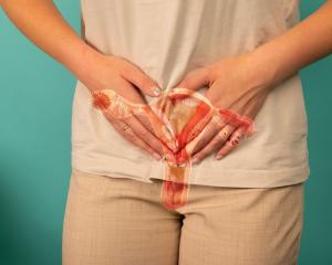 Laparoscopic Excision of Endometriosis