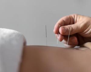 Acupuncture Wellness