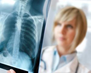 A bone density x-ray