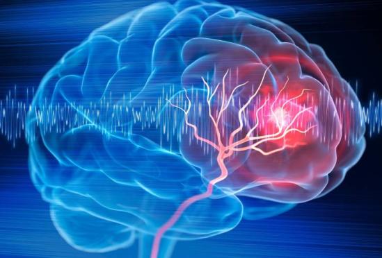 Brain & Stroke Care