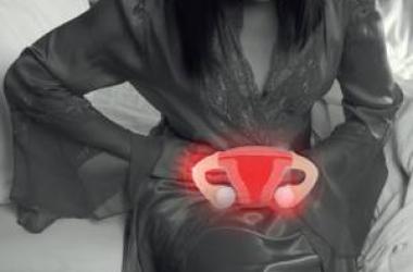 Endometriosis