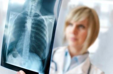 A bone density x-ray