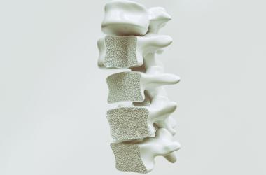 Preventing Osteoporosis