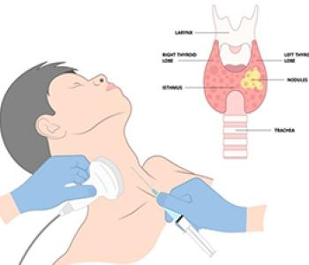 Image Guided Biopsy