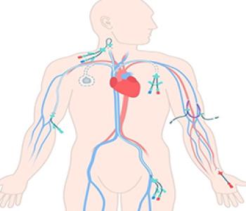  Central Venous Access