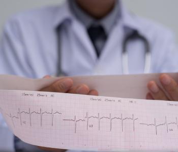 EKG (Electrocardiogram)