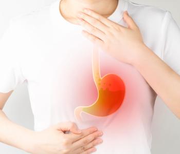 Acid Reflux