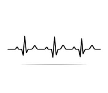 EKG