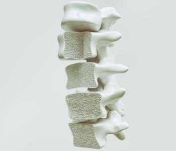 Osteoporosis