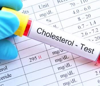 Cholesterol