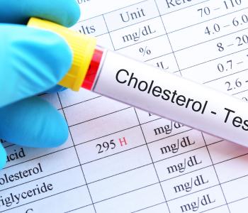 A physician holding a cholesterol test